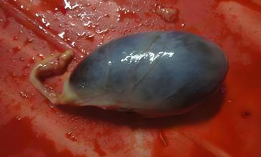 豬膽的功效與作用是什么，有什么功效作用與好處？